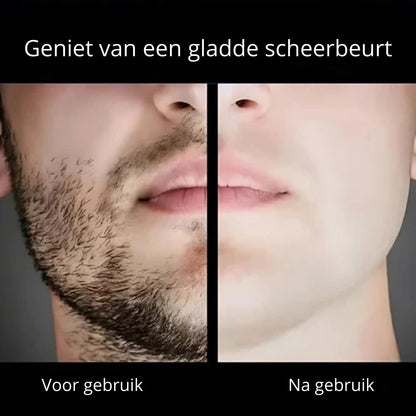 SmartShaver | Draadloos Elektrisch Scheerapparaat