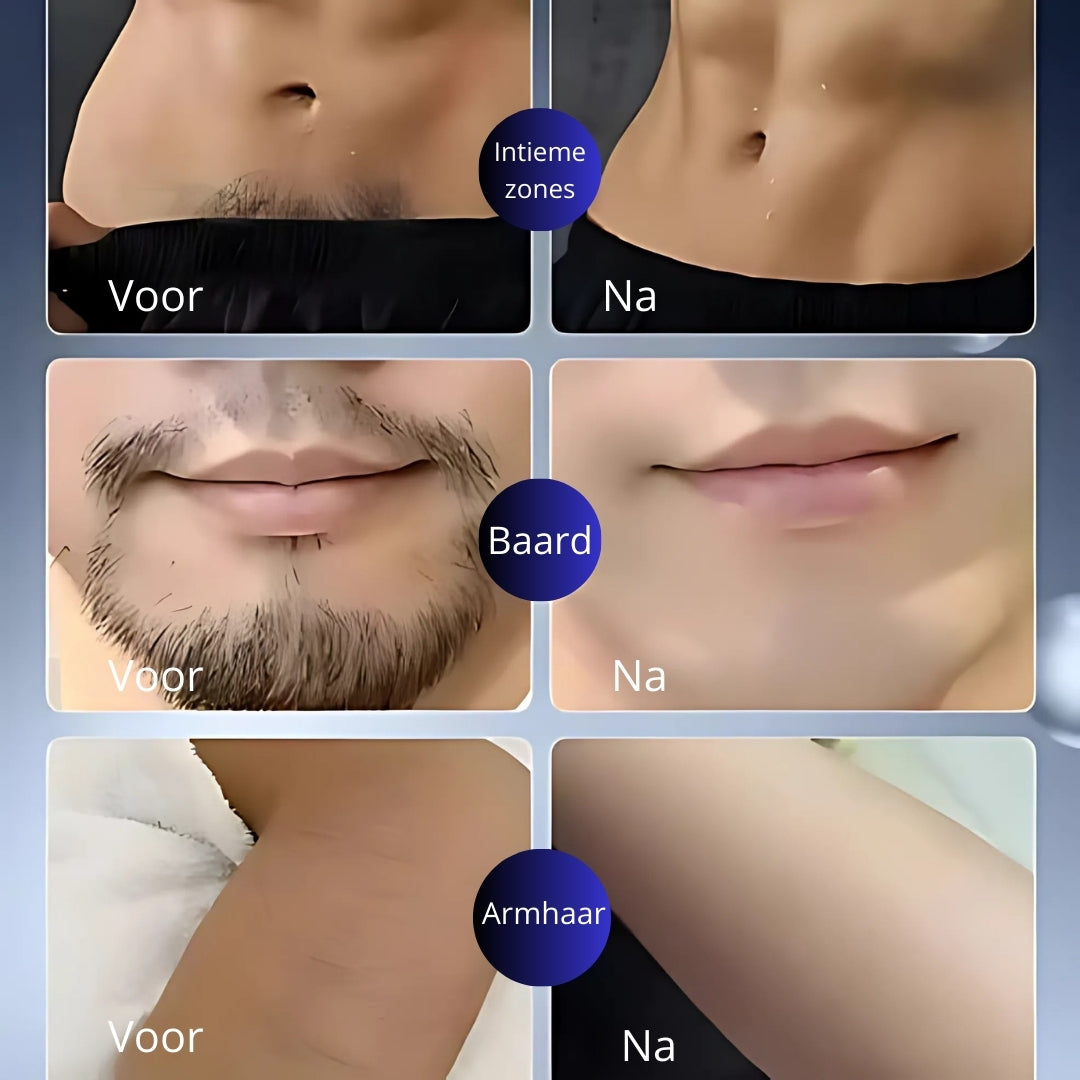 SmartShaver | Draadloos Elektrisch Scheerapparaat